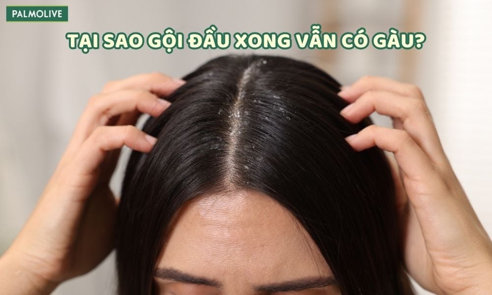 tại sao gội đầu xong vẫn có gàu - why-still-have-dandruff-after-washing-hair