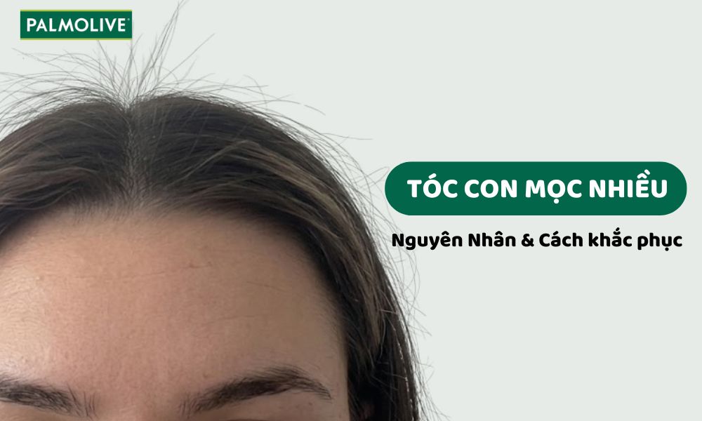 Hình ảnh quảng cáo của Palmolive hiển thị phần trán và đỉnh đầu của một người phụ nữ với nhiều tóc con mọc dựng đứng, kèm theo tiêu đề "Tóc con mọc nhiều: Nguyên nhân & Cách khắc phục