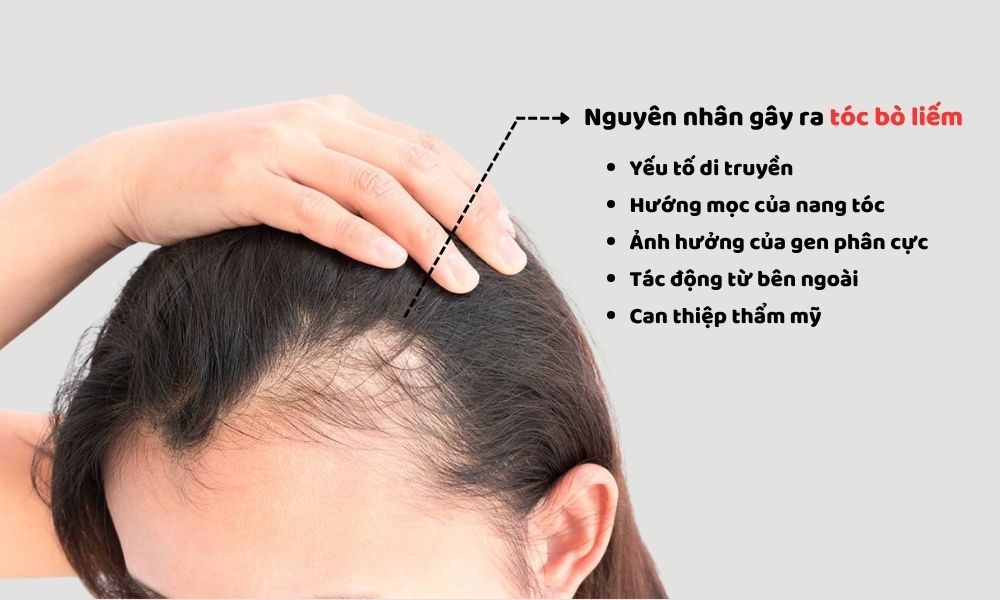 Nguyên nhân gây ra tình trạng tóc bò liếm 