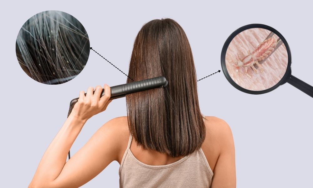 Ép tóc có hết chấy không