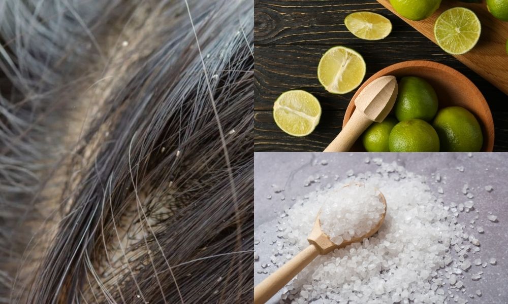 Trị chấy bằng chanh tươi và muối giúp loại bỏ chấy và trứng chấy hiệu quả