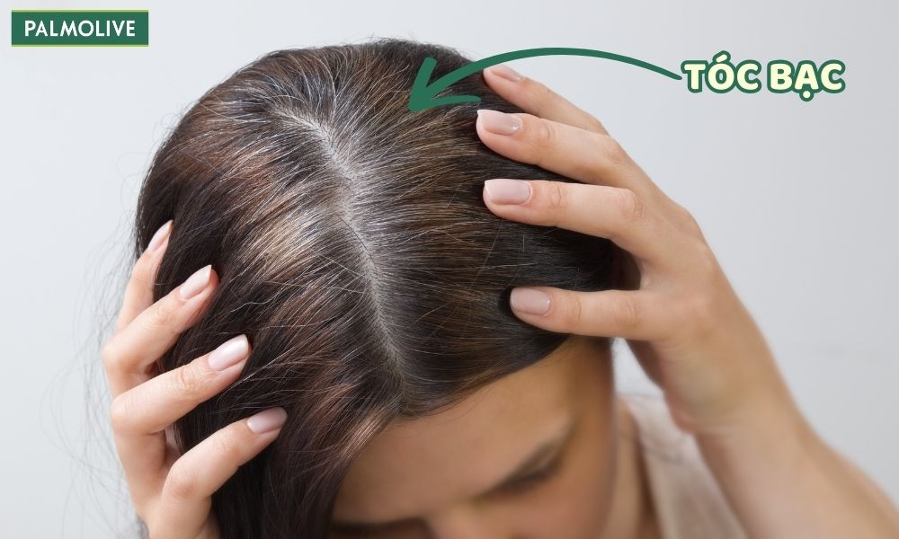 Tóc bạc là hiện tượng tóc dần chuyển sang màu trắng vì nang tóc ngừng hoặc giảm sản xuất melanin