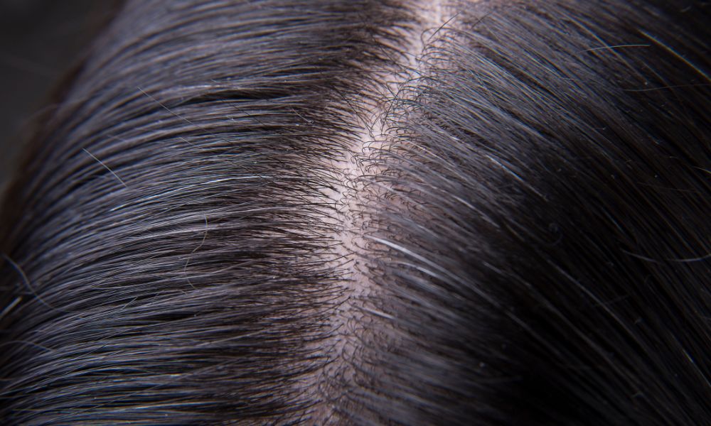 Giữ da đầu sạch sẽ giúp da đầu thông thoáng, hạn chế nguy cơ gãy rụng và tóc bạc sớm