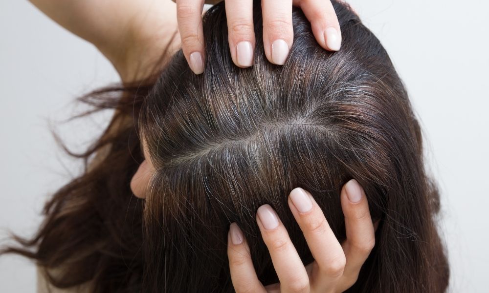 Tóc bạc sớm ở nữ là hiện tượng các sợi tóc bạc xuất hiện ở giai đoạn trước 40 tuổi