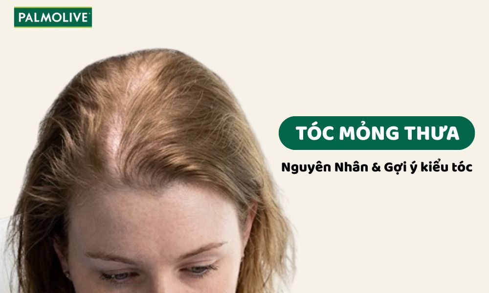Tóc mỏng thưa