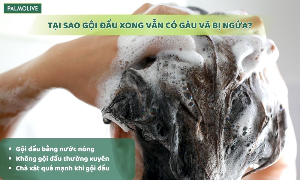 Gội đầu bằng nước nóng khiến da đầu bị khô và bong tróc, sinh ra gàu